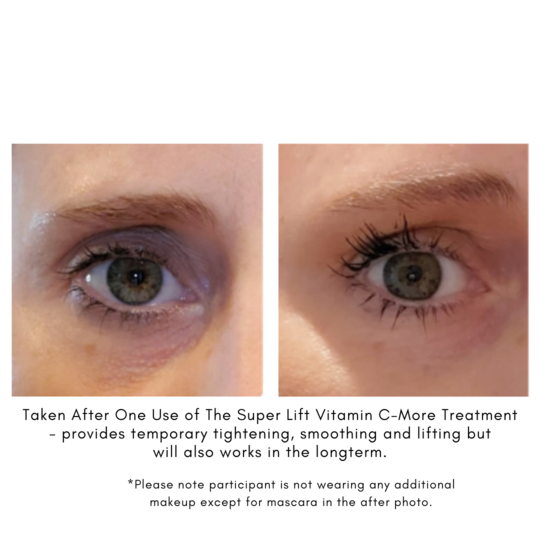 The Super Lift | Vitamin C-More Teatment (6585543131207)
